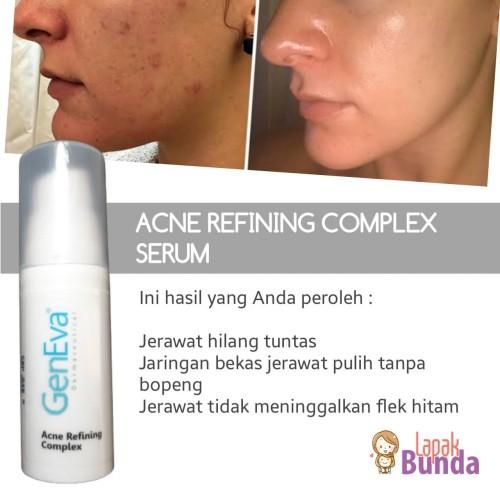 SERUM ACNE REFINING COMPLEX GENEVA